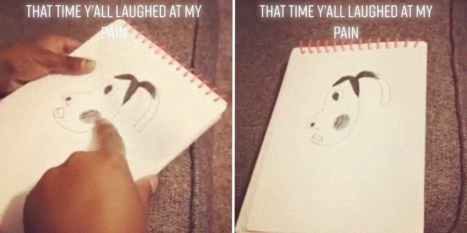 hyperpigmentation meme