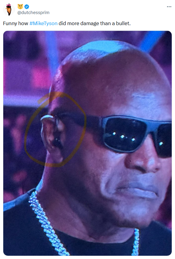 Mike Tyson fight meme with a photo of a man with cauliflower ear.