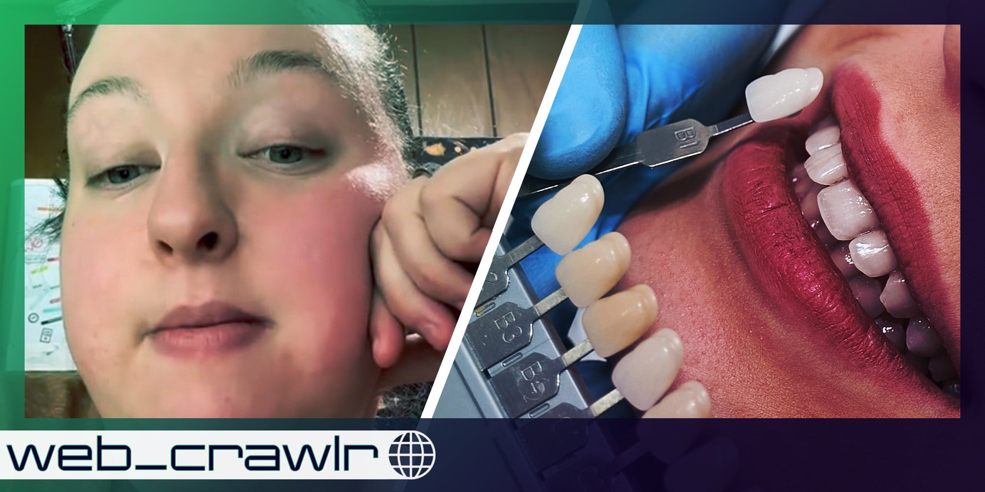 Woman talking(l), Dentist holding up fake teeth to mouth(r) web_crawlr logo over it