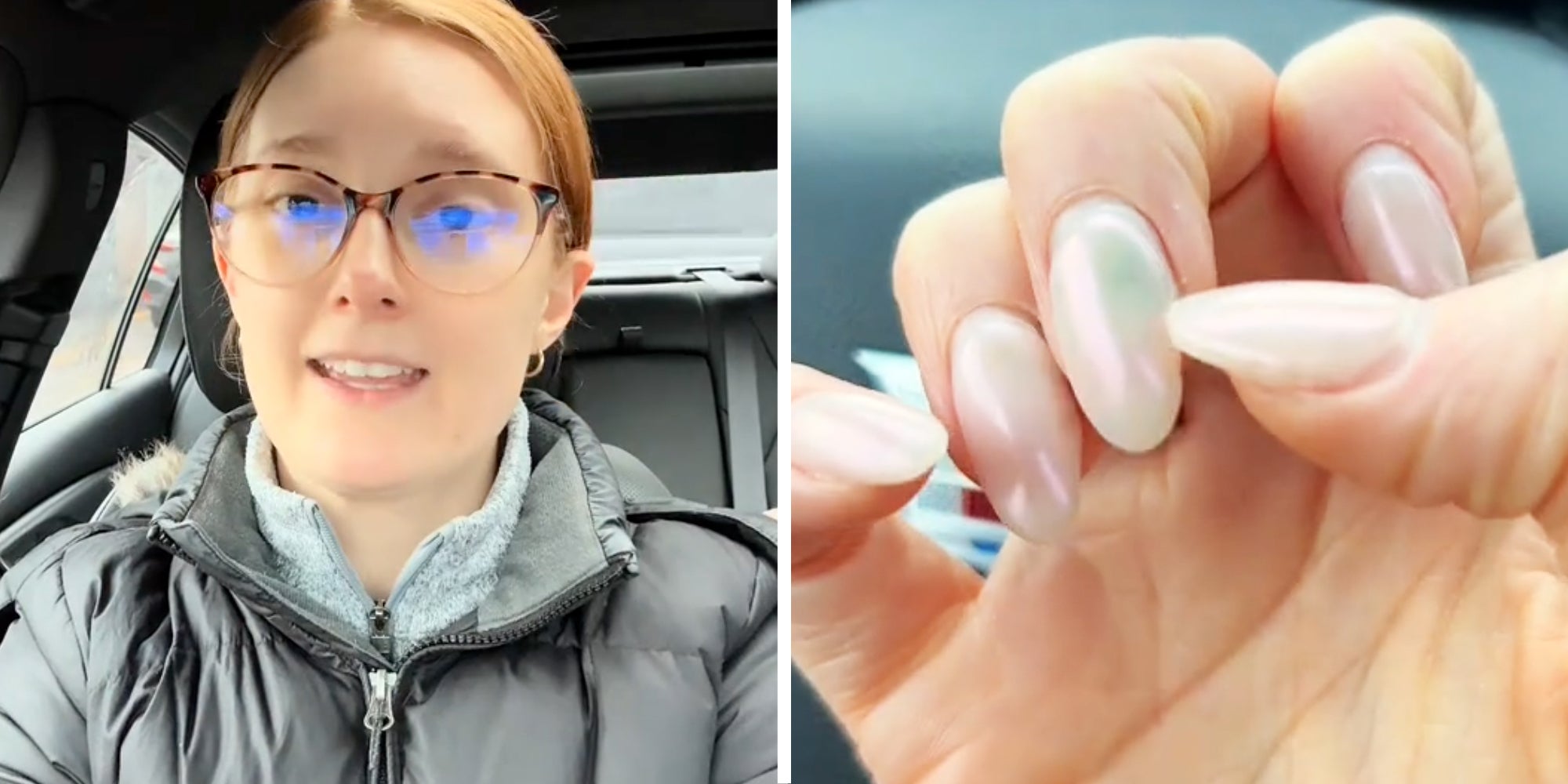 ‘I’m a nail tech and it is 100% illegal’: Woman gets her nails done. Then she notices fungus under her nails