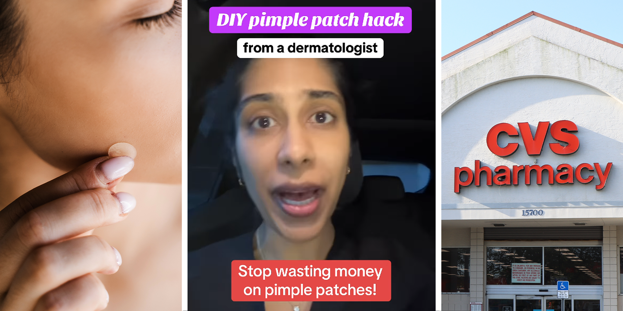 3 Split Image. Hand holding pimple patch on face on left. Dermatologist explaining pimple patch hack with text that reads: 'DIY pimple patch hack from a dermatologist' 'Stop wasting money on pimple patches!' in center. CVS storefront on right.