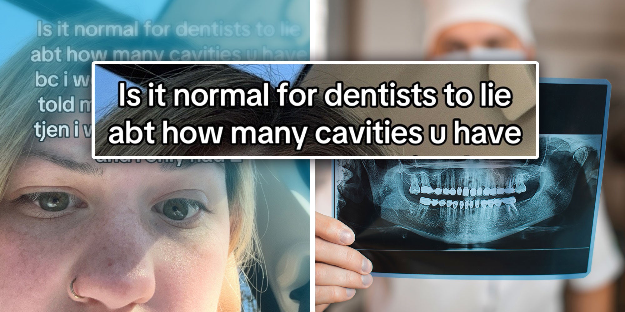 Screenshot of Tiktok user @bibblebiterbutt with a obstructed caption; Photo of a dentist holding up an XRay of Teeth; Isolated caption: 'Is it normal for dentists to lie abt how many cavities u have'.