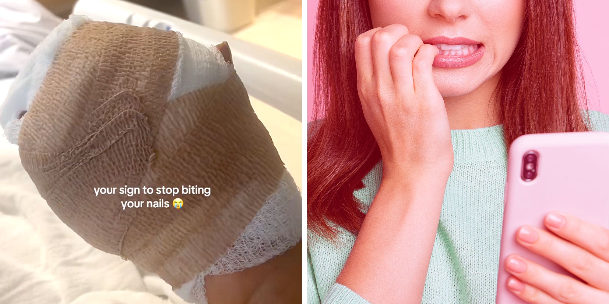 Screenshot of Tiktok user @breezzyy.yy's bandaged hand with the caption 'your sign to stop biting your nails'; Photo of a woman holding a phone and biting her nails.