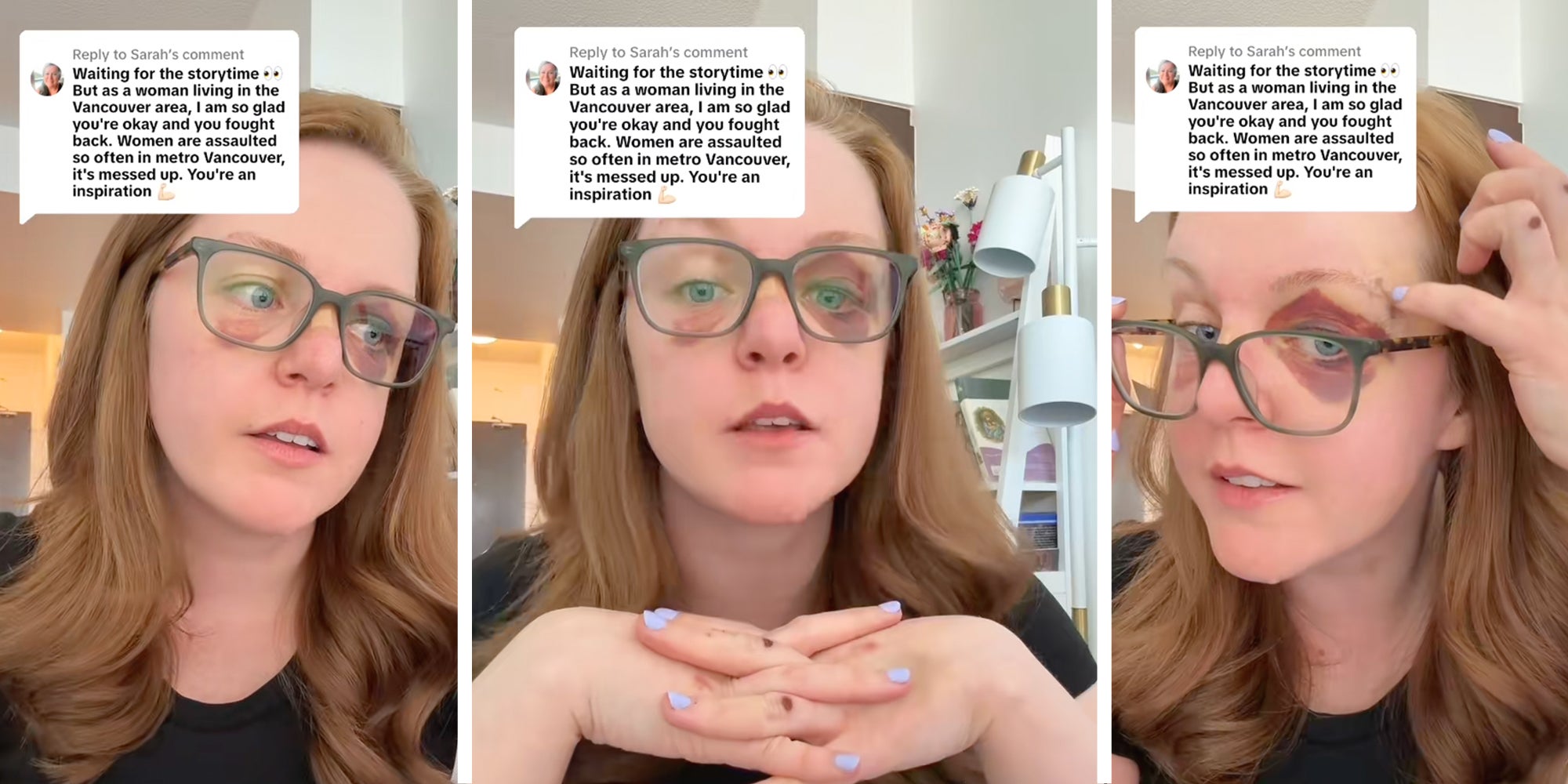 Three panel image of a young woman with wounds to her face.