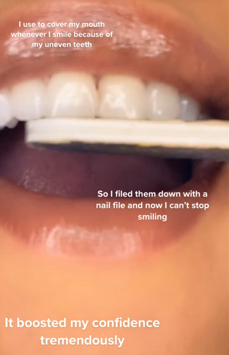 TikTok video showing a close-up of someone filing their teeth with a nail file.