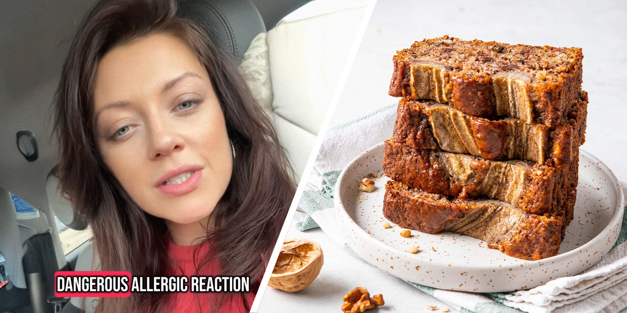Picture of TikTok is obsessed with this story of a banana bread allergy, a cheati