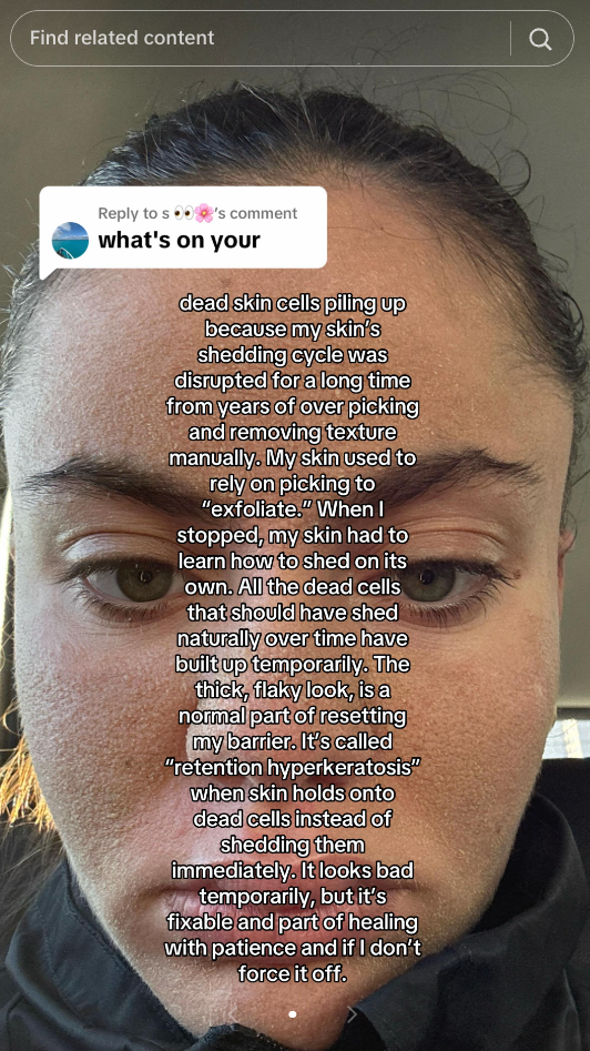 In Body Image