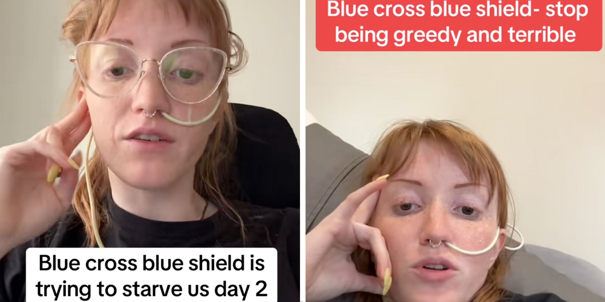 Woman with a feeding tube