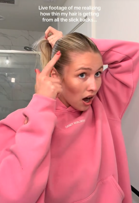 Slicked back bun traction alopecia TikTok video with a woman pointing to her scalp.