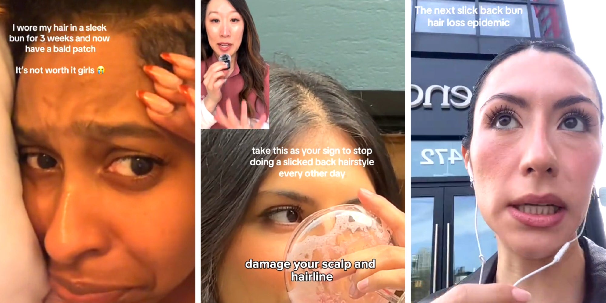 3 panel image of people dealing with the condition described.