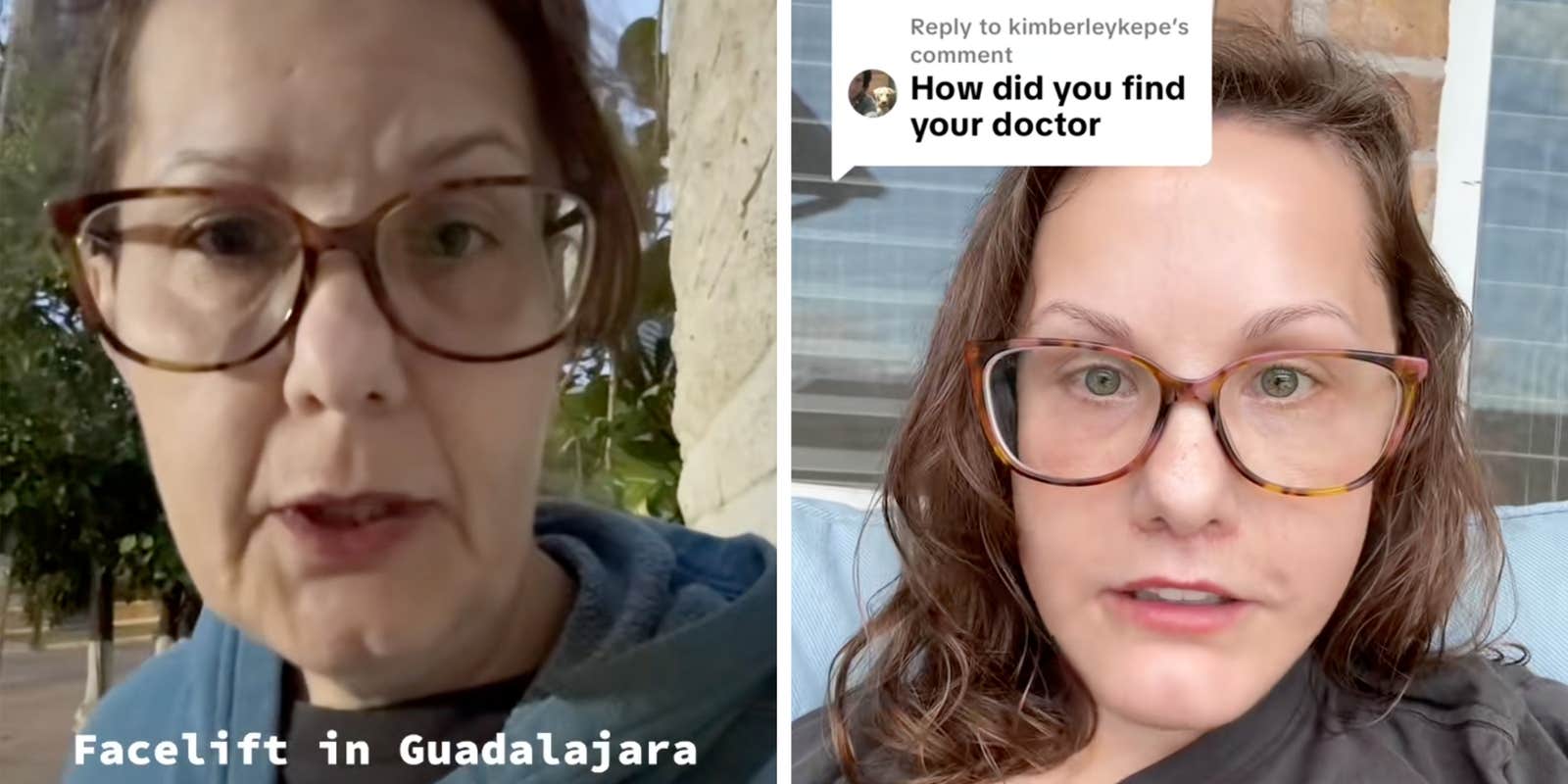 50-year-old woman's viral Guadalajara facelift has TikTok stunned