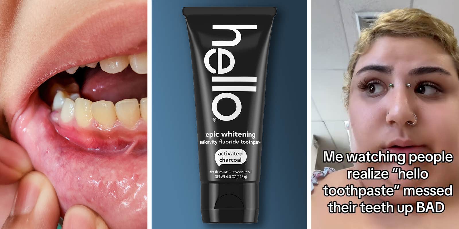 Does Hello Toothpaste Damage Teeth?
