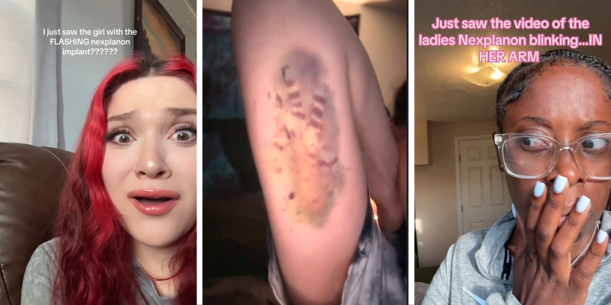 3 panel image of the a womans arm and 2 other people reacting to it.