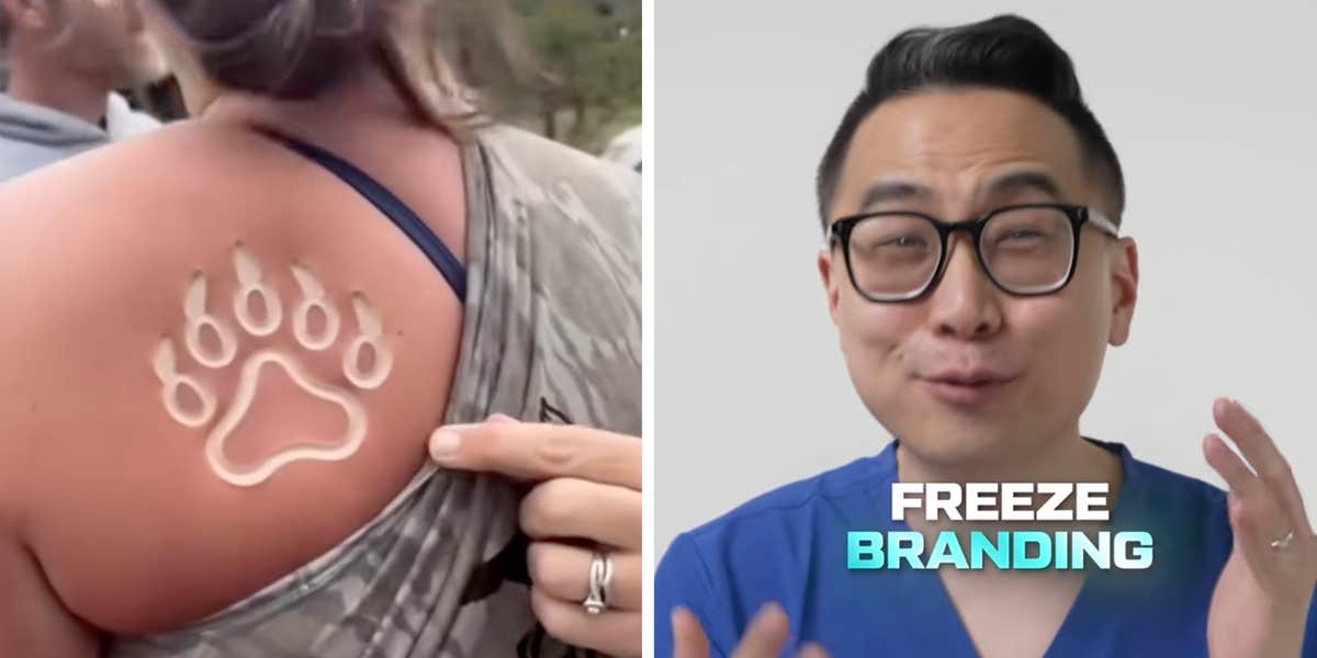 What is Freeze Branding, The New TikTok Trend?