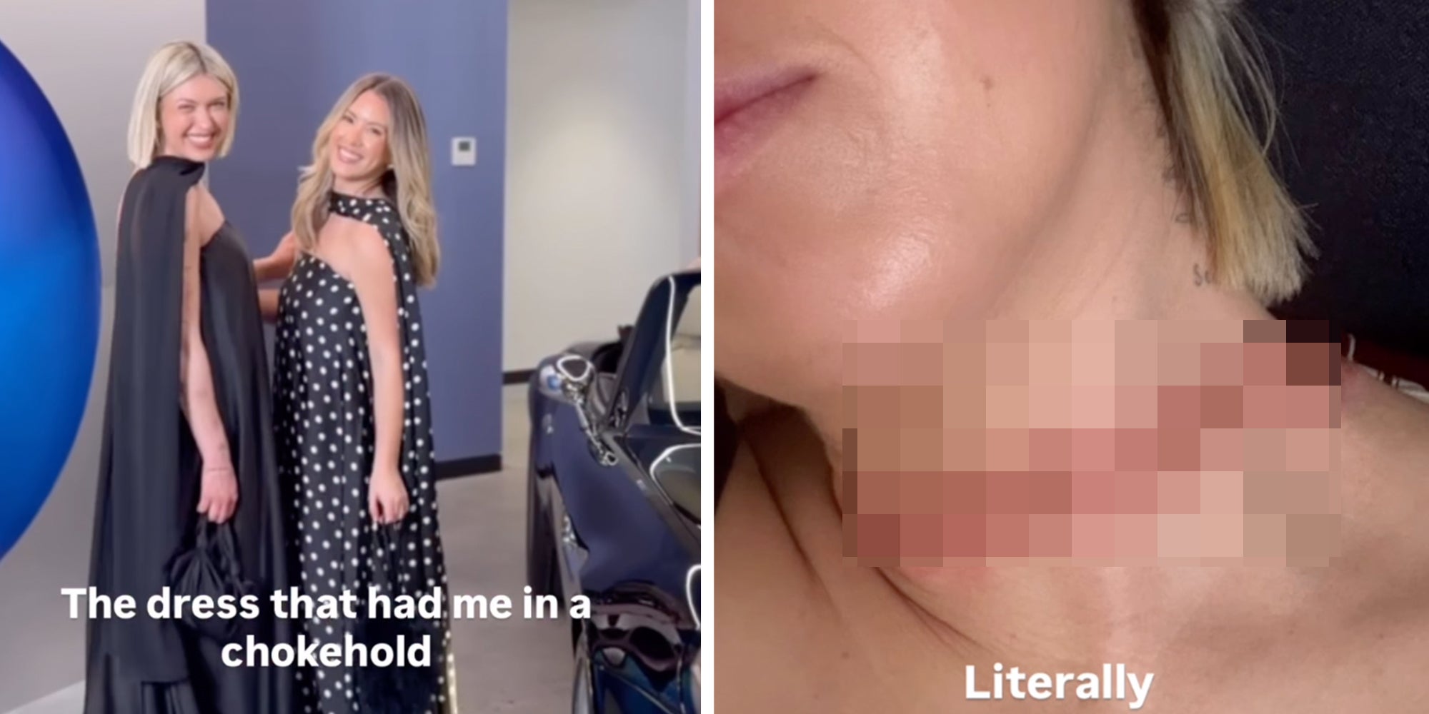 Homepage article image