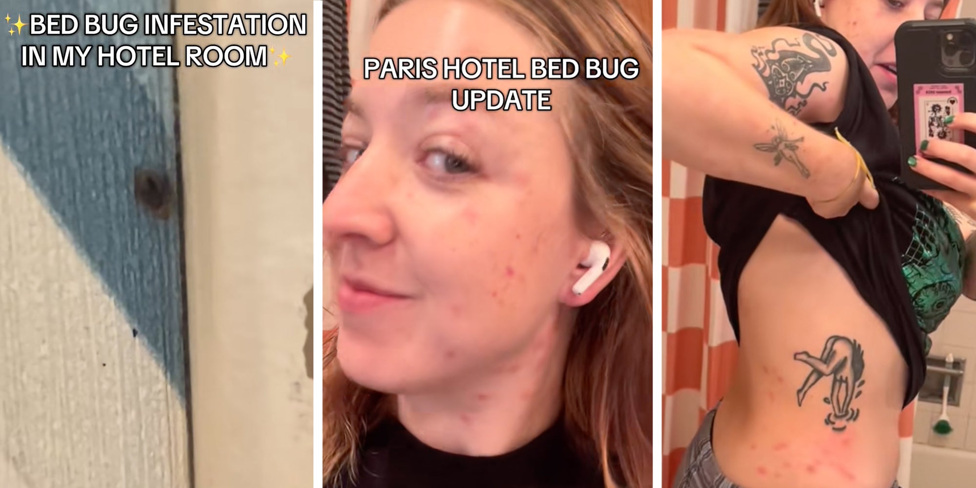 3 panel: Left: Bed bugs in Paris hotel room. Middle: Woman with bed bug bites all over her face Right: Same woman showing bed bug bits in mirror along her body.