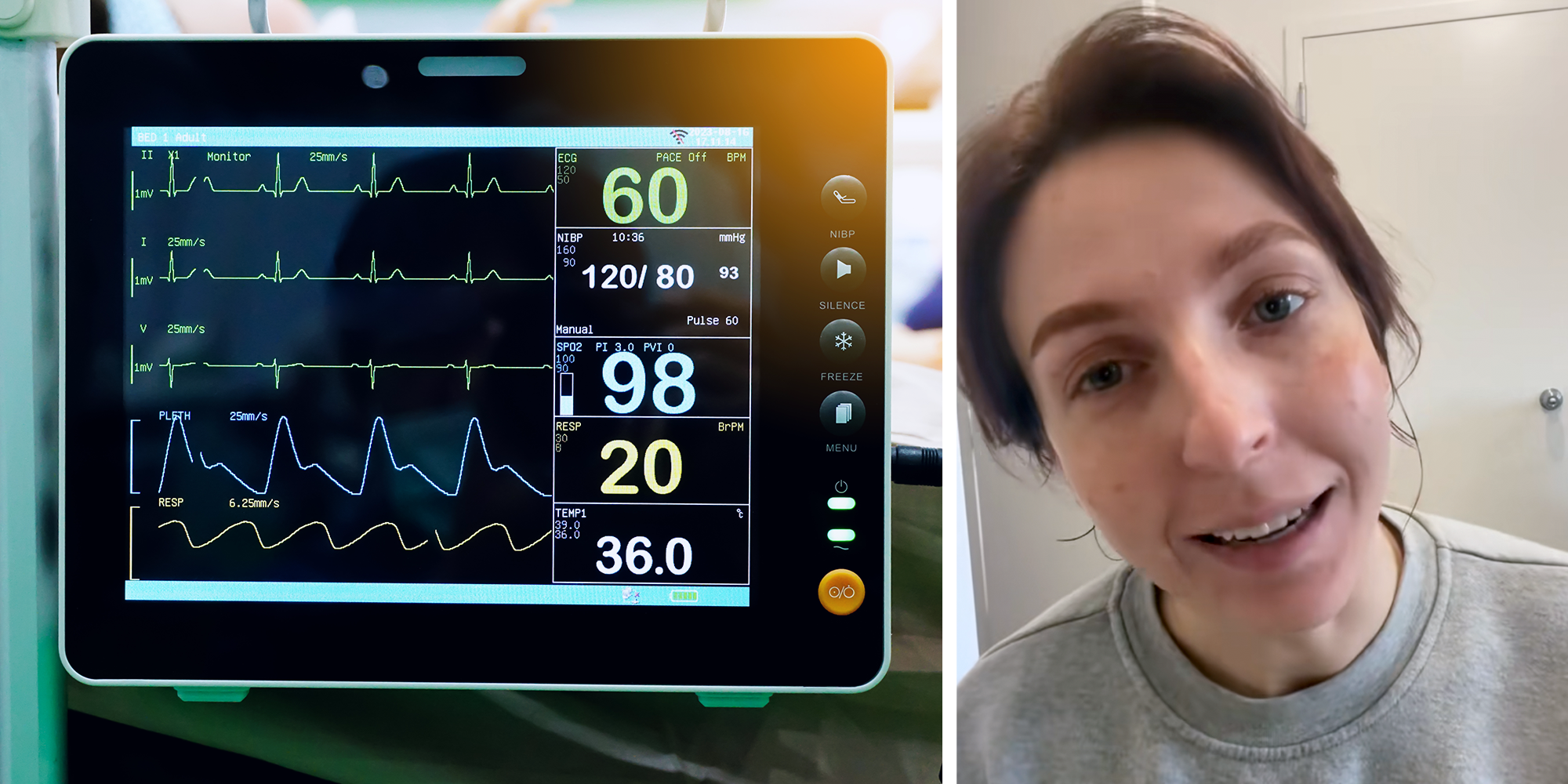 ai ekg goes wrong