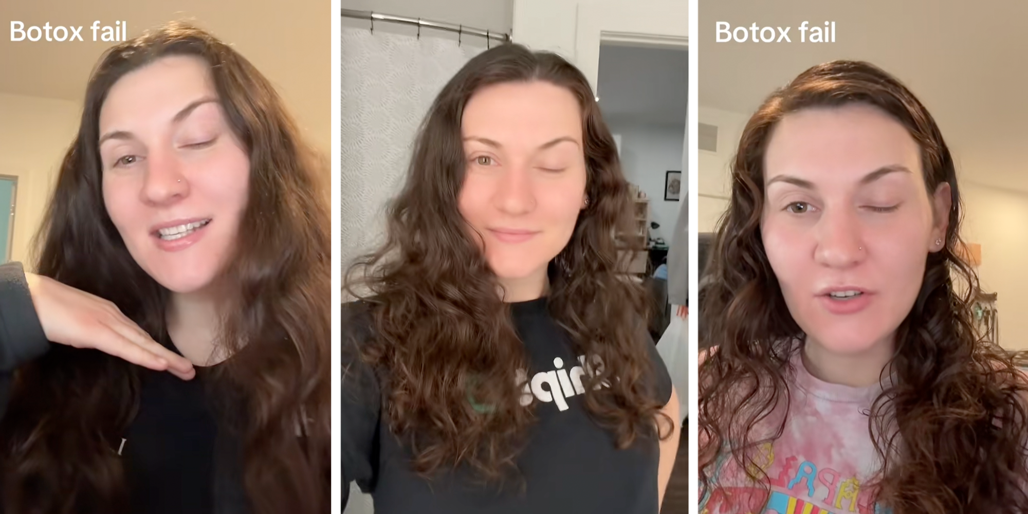 botox fail viral tiktok