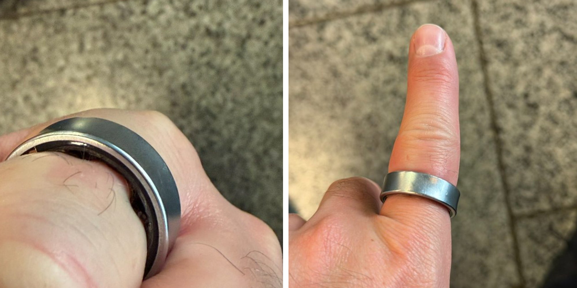 Samsung Galaxy Ring swelling on a finger.