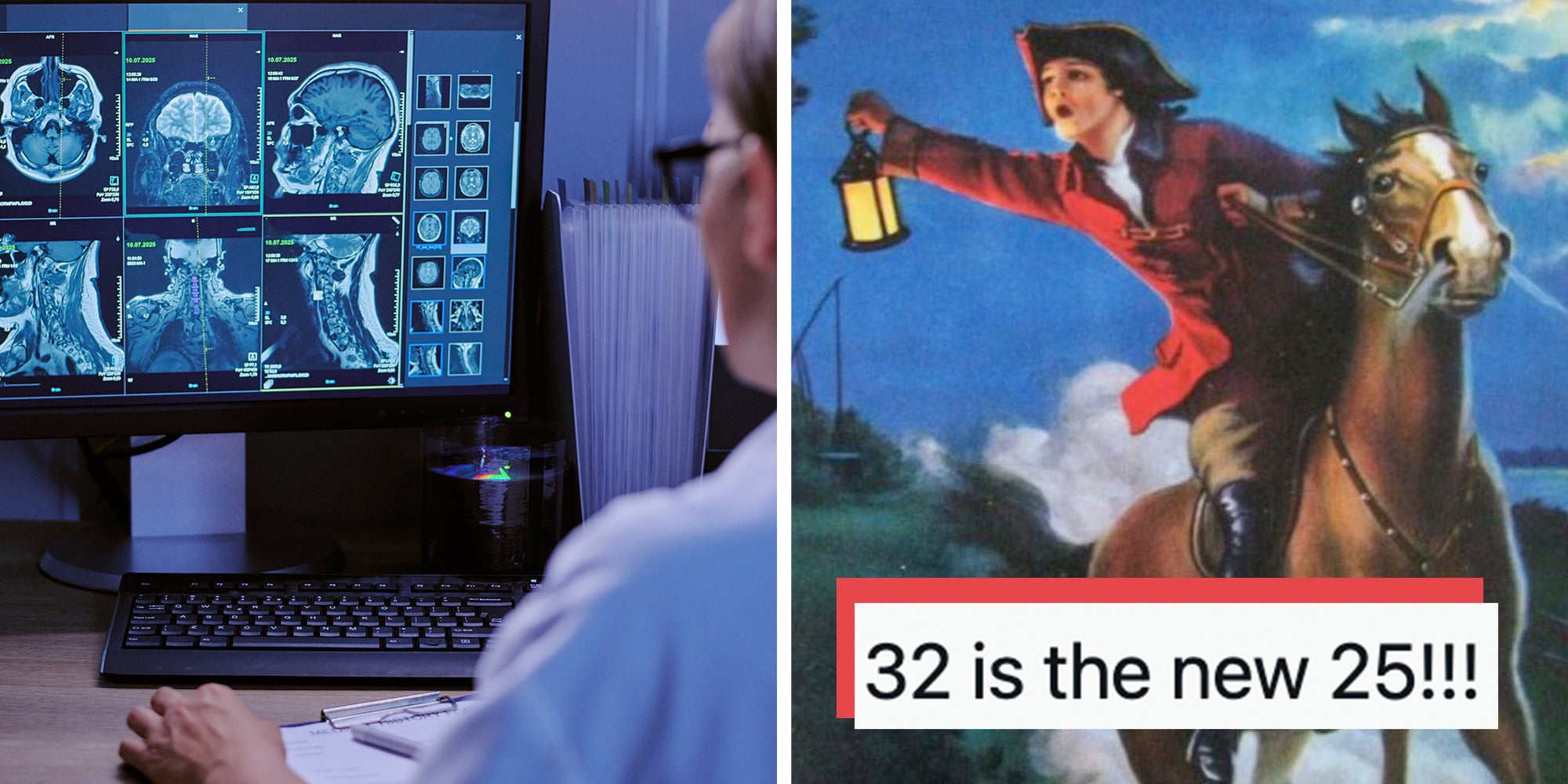 Left: Middle aged woman analyzing brain and spinal MRI scans on computer monitor in medical office. Right: Paul revere meme, text overlay reads, "32 is the new 25!!!"