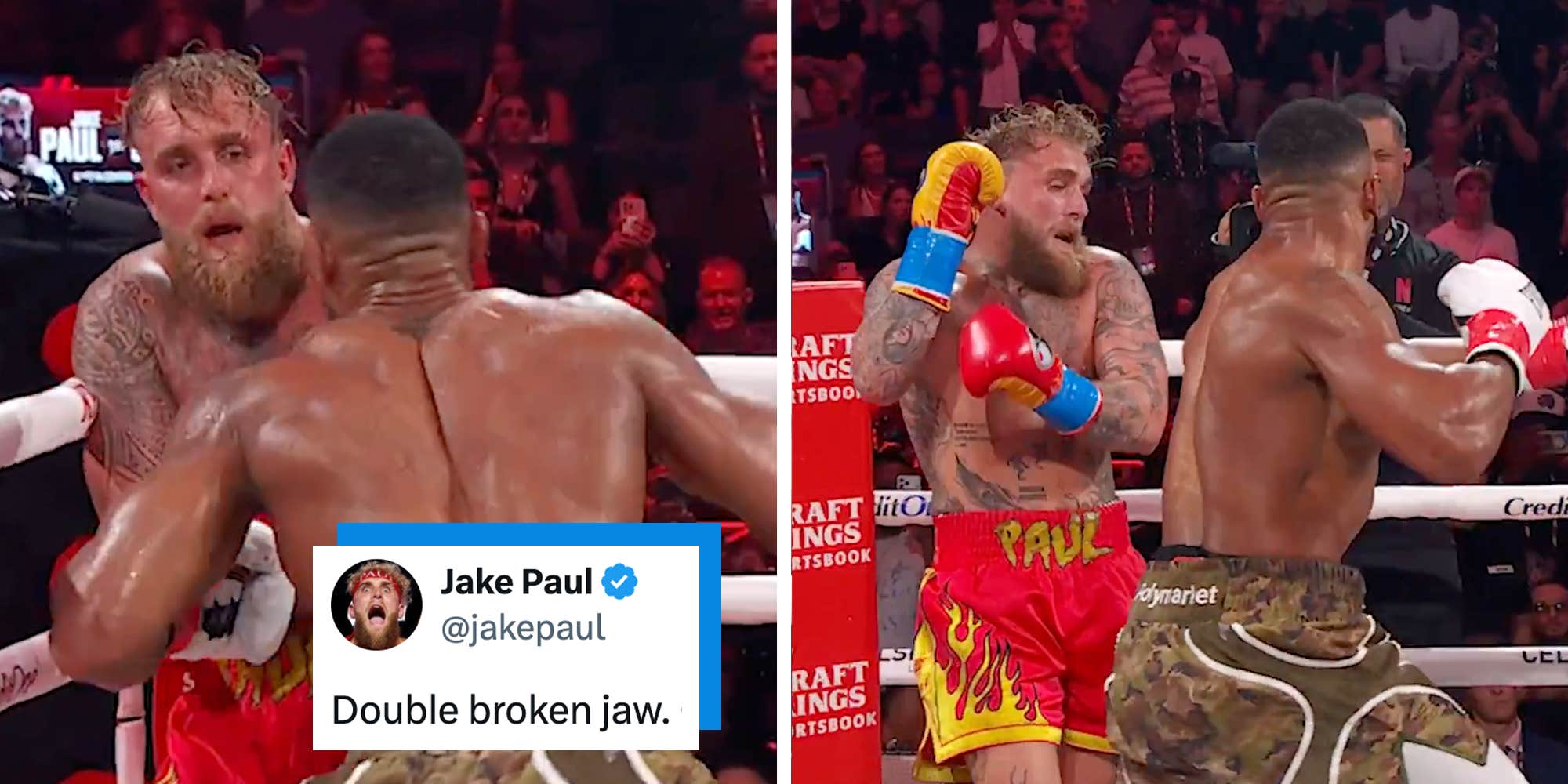 Jake Paul’s broken jaw divides the internet after Netflix fight