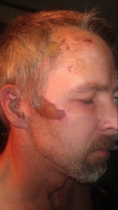 Jeffery Bane injury photo