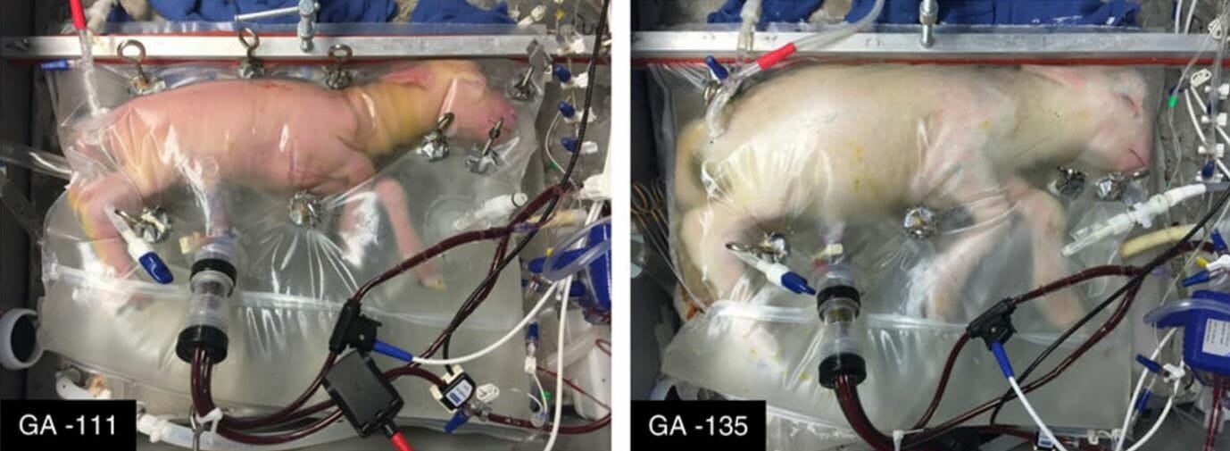 artificial womb placenta lamb premature babies