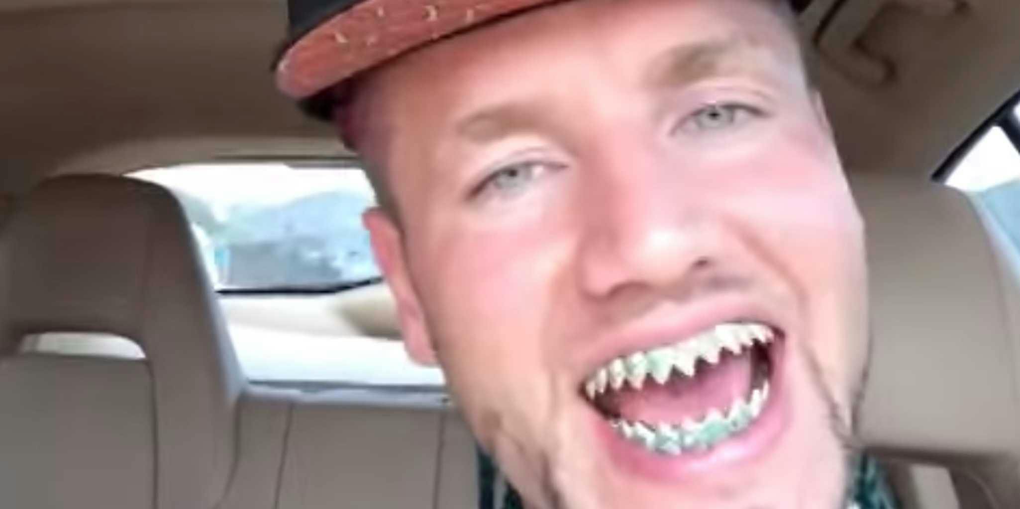 What the hell is up with Riff Raff's teeth? An explainer