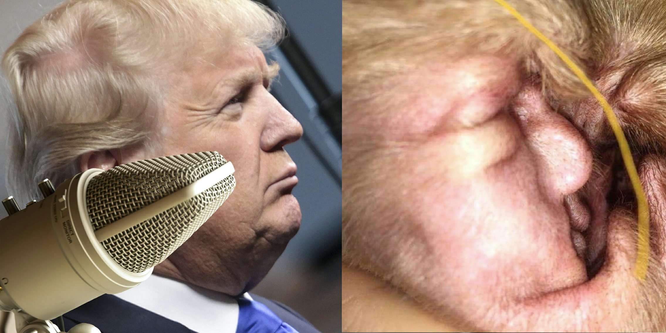 We're All Gonna Die podcast discusses Donald Trump looking like a cyst in a dog's ear