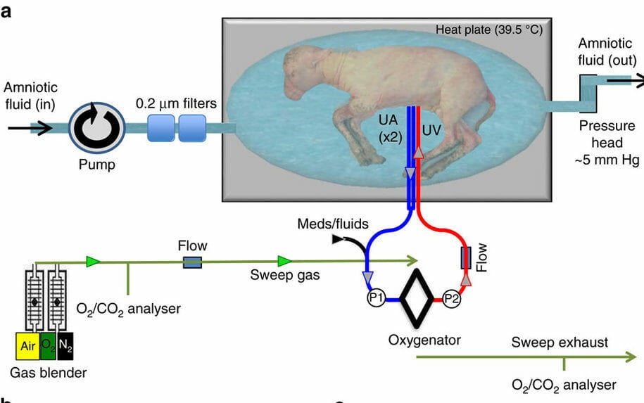 artificial womb placenta lamb premature babies