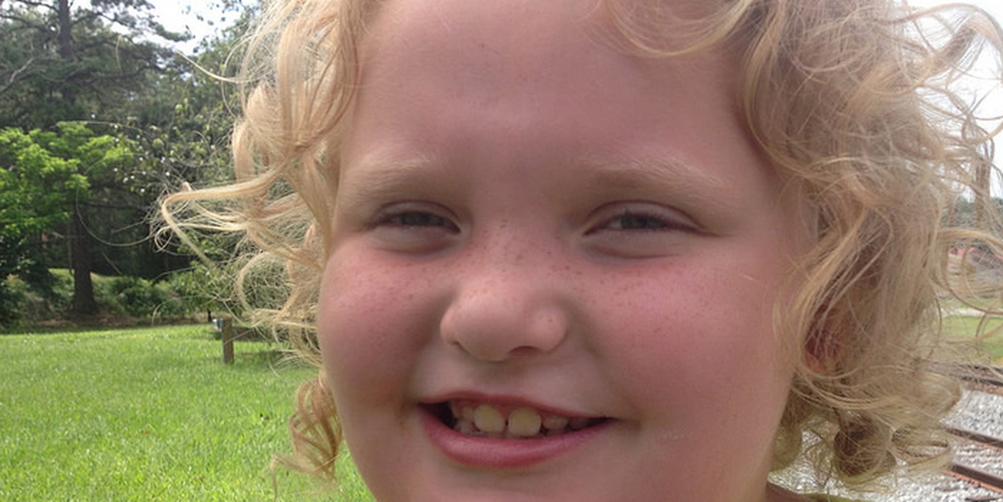 Homepage article image