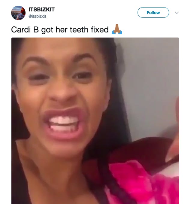 cardi b teeth