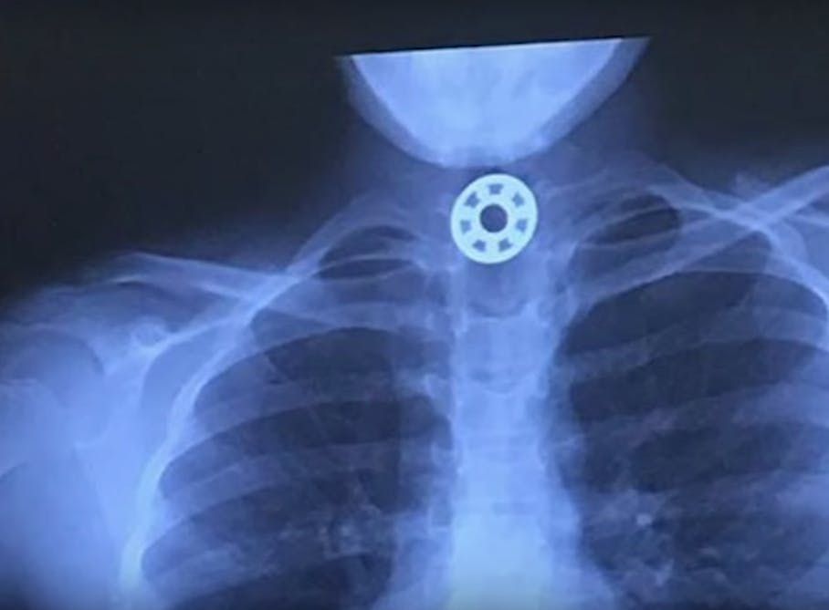 fidget spinner x-ray