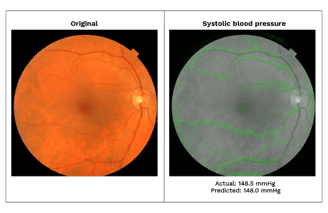 Sample retinal images highlighting important areas