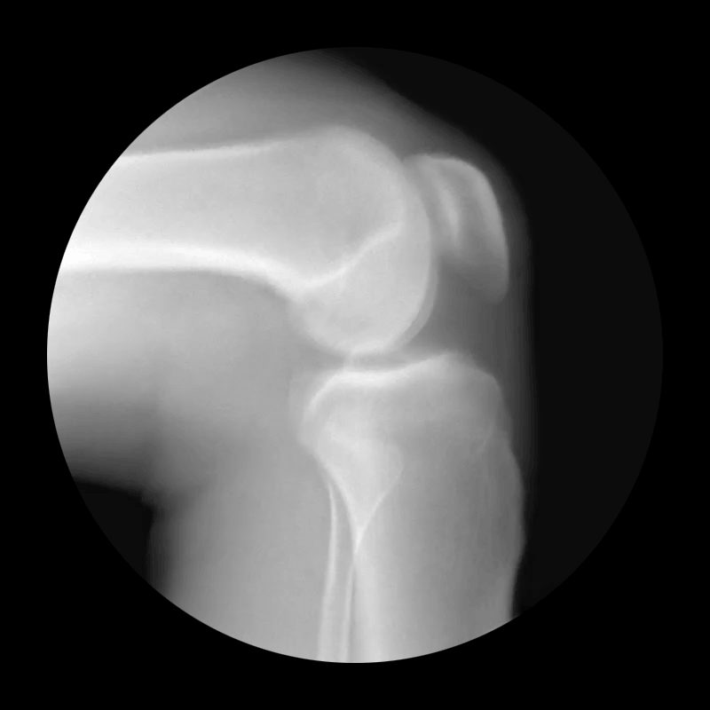 These Xray GIFs will give you new appreciation for your bones