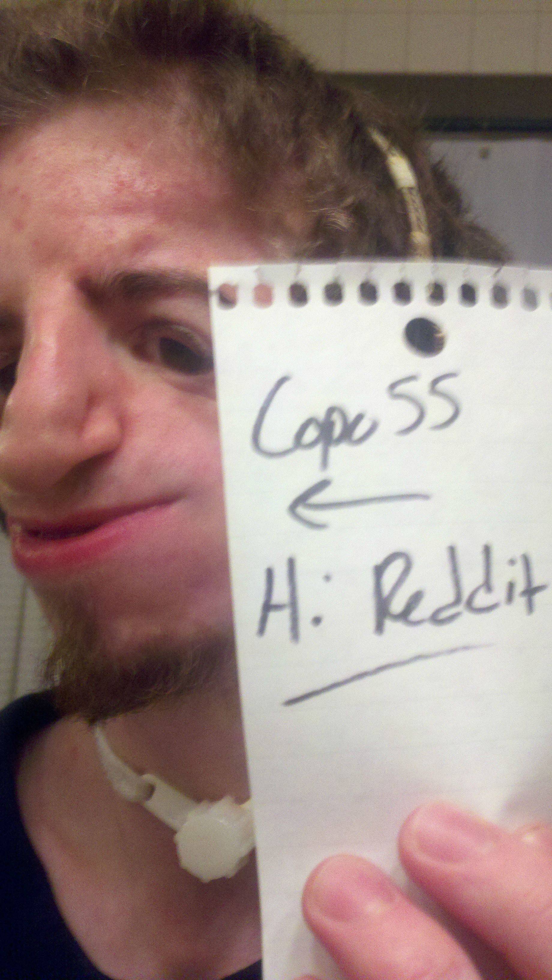 Homepage article image