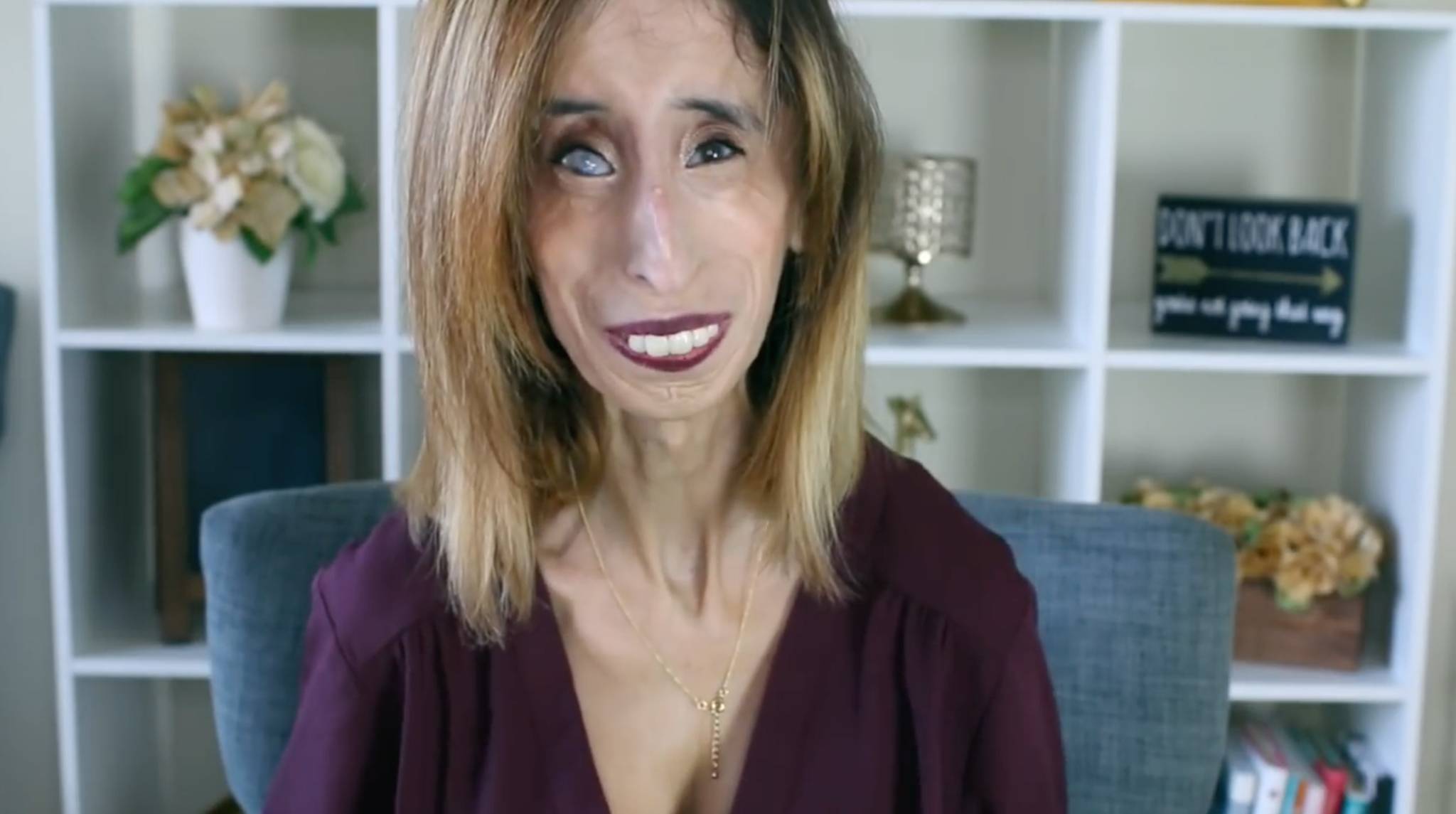 Lizzie Velasquez Pics