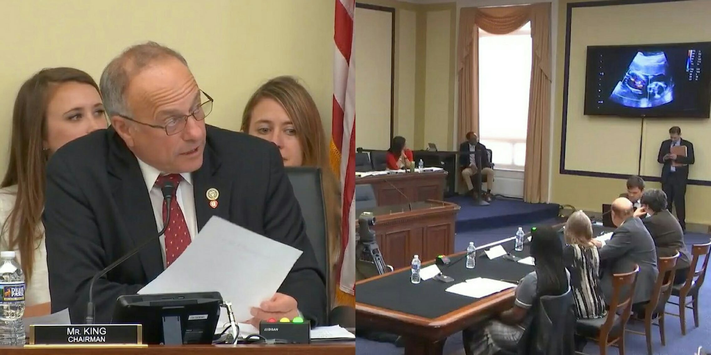 Rep. Steve King narrates an ultrasound during a House Judiciary Committee Hearing