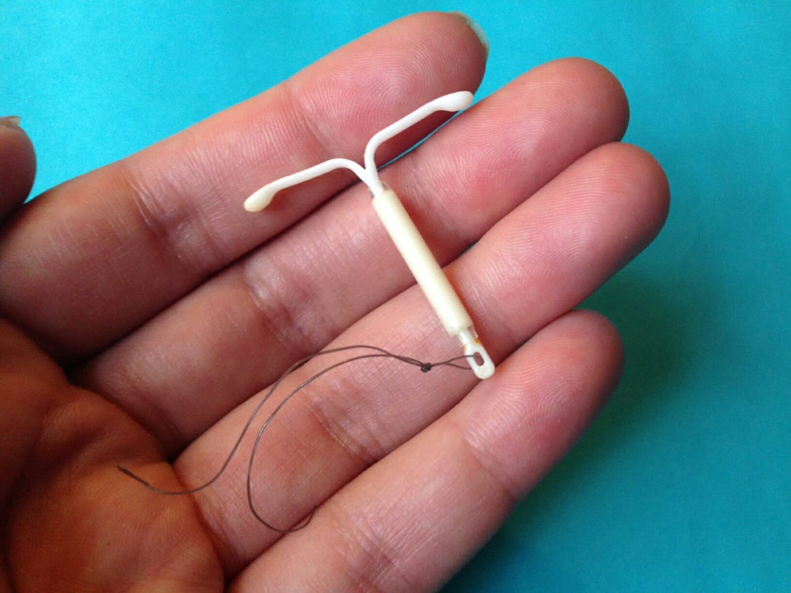 what is an iud : mirena iud