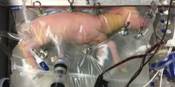 artificial womb placenta lamb premature babies