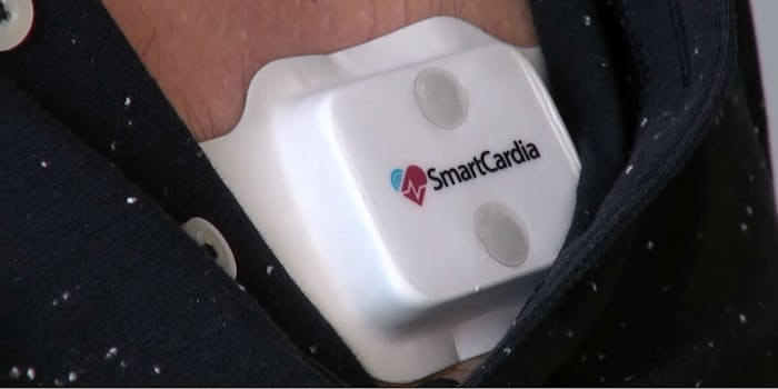 smartcardia wearable health patch heart