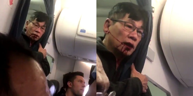 Video of Man Dragged Off United Flight 3411