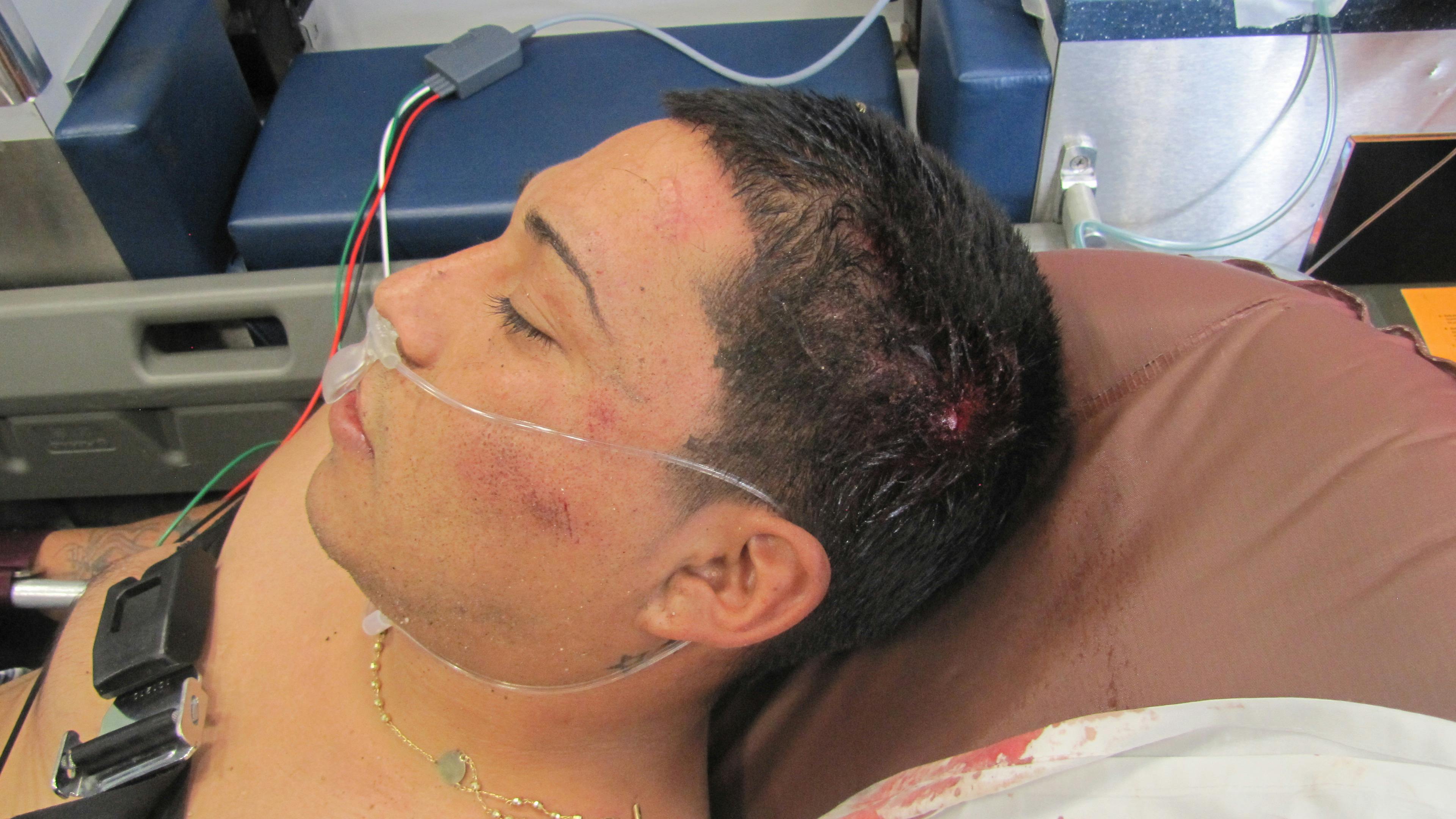 Cuts and bruises shown on David Flores' head after his Aug 14. arrest