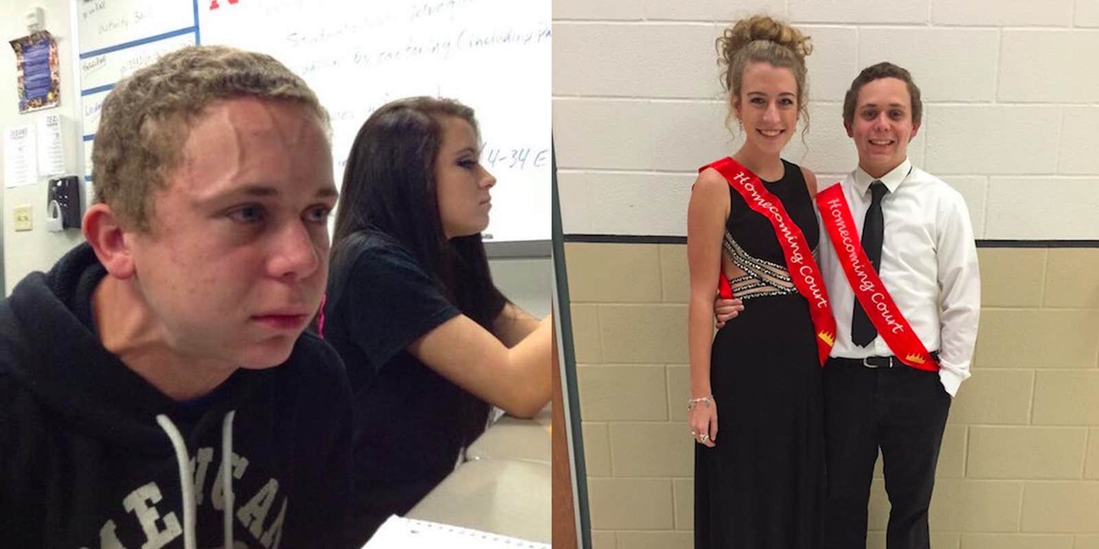 Kid Straining Mem Kid With Veins Meme: How A Teen's Forehead Vein Became a Meme