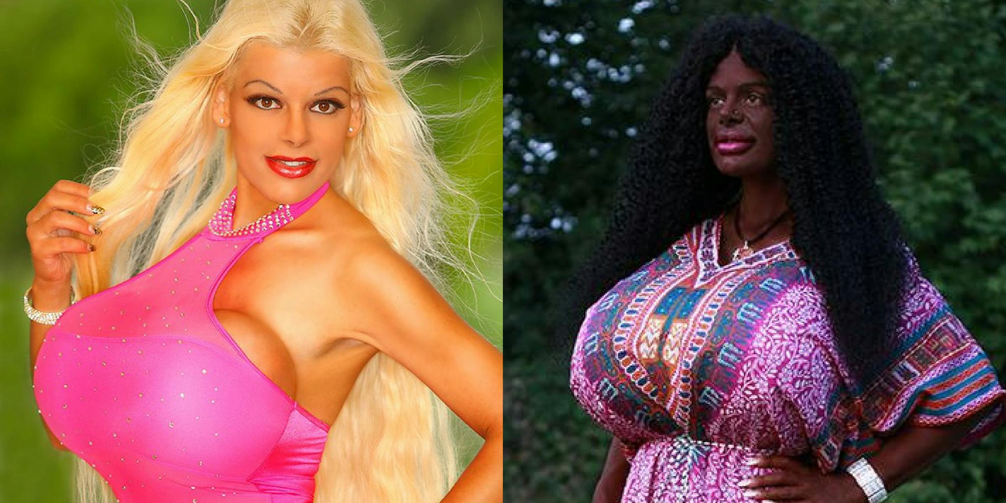White model with biggest boobs in Europe 'turns black' after tanning  injections and claims to be African