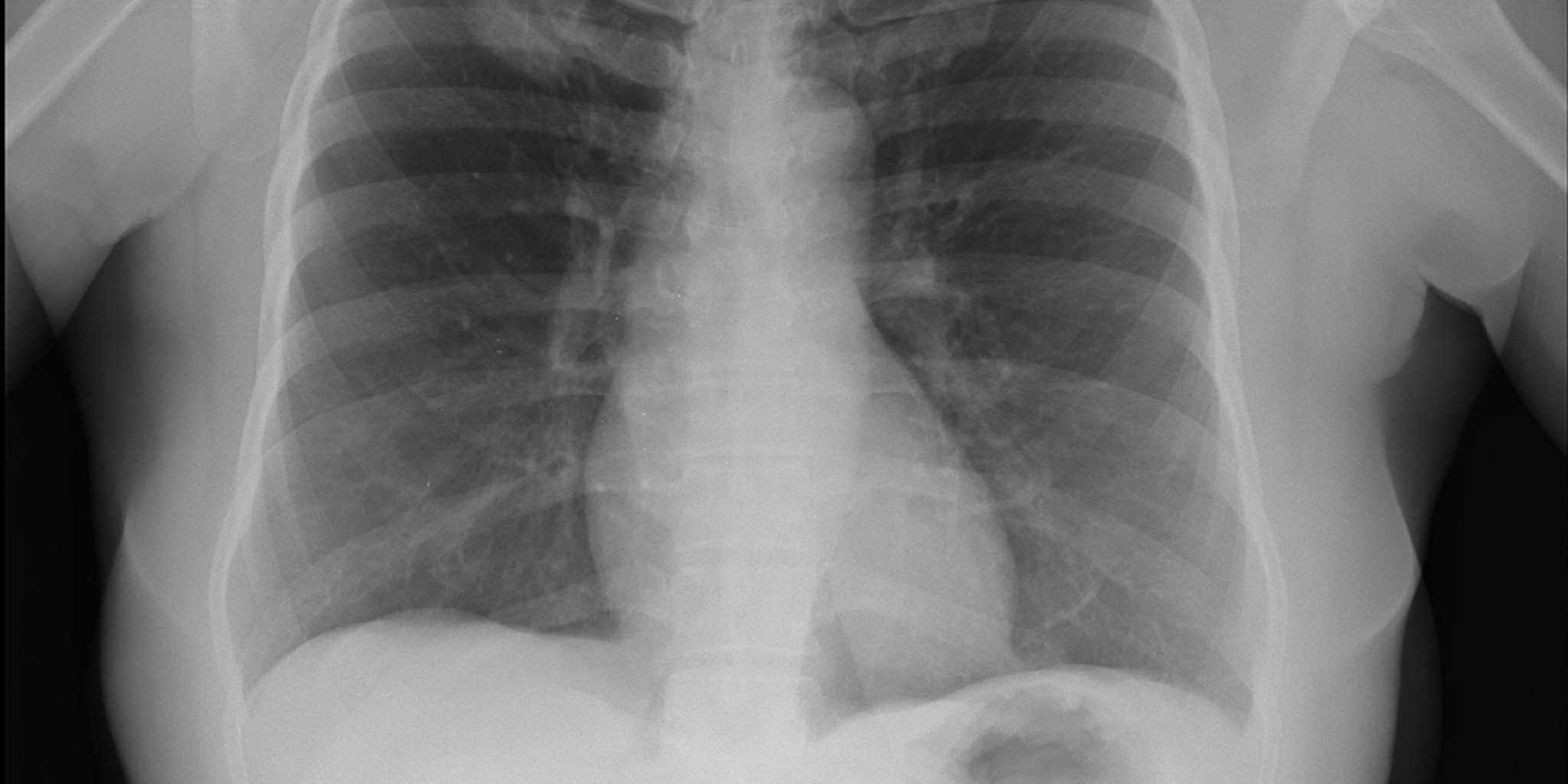 Is The Gorecenter Effect Making You Sick? This Study Has Answers. - 5l3mo8n
