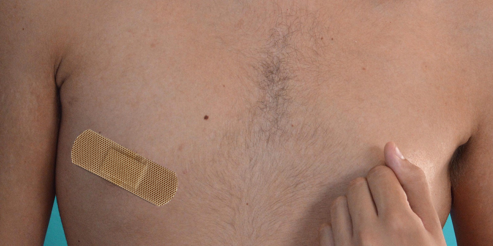 Man with bandage over nipple